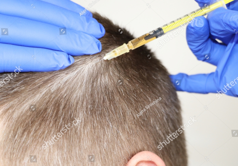 Haartherapie